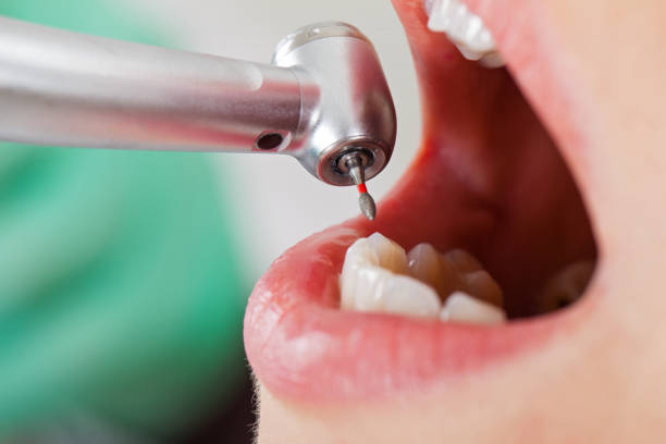 Best Pediatric Emergency Dentist in Danville, PA